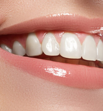 Estética Dental: Transformando Sonrisas y Elevando la Confianza