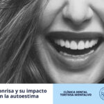 Diseño de sonrisa Dra Rodríguez y su impacto positivo en la autoestima y las relaciones personales