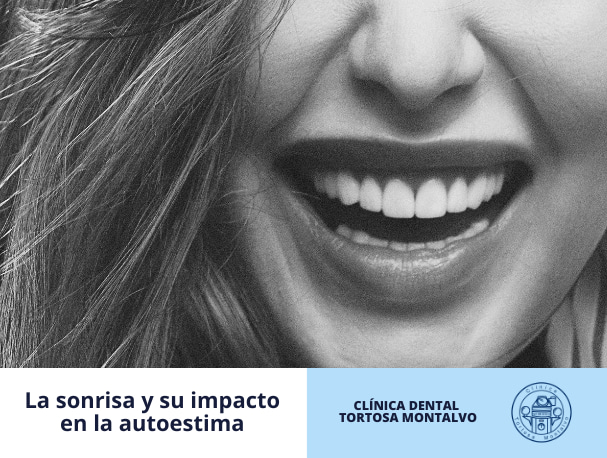 Diseño de sonrisa Dra Rodríguez y su impacto positivo en la autoestima y las relaciones personales 1 Diseño de sonrisa Dra Rodríguez y su impacto positivo en la autoestima y las relaciones personales